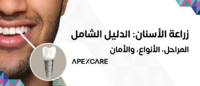 زراعة الأسنان – عيادات أبكس كير بالقصيم