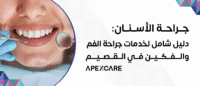 جراحة الأسنان: دليل شامل لخدمات جراحة الفم والفكين في القصيم – Apex Care